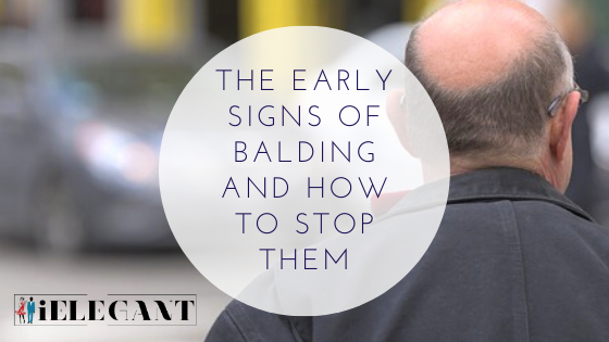 The Early Signs of Balding and How to Stop Them